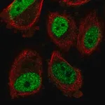 Merck Anti-ABHD8 antibody produced in rabbit