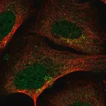 Merck Anti-SLA2 antibody produced in rabbit