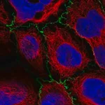 Merck Anti-PLEKHG6 antibody produced in rabbit