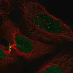 Merck Anti-CENPC antibody produced in rabbit