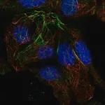 Merck Anti-TRMT10A antibody produced in rabbit