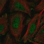 Merck Anti-KLF11 antibody produced in rabbit