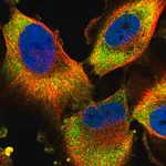 Merck Anti-PFDN2 antibody produced in rabbit