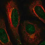 Merck Anti-ACAP3 antibody produced in rabbit