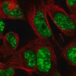 Merck Anti-RNF169 antibody produced in rabbit