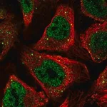 Merck Anti-CSRNP1 antibody produced in rabbit