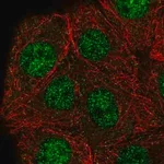 Merck Anti-GABPB2 antibody produced in rabbit