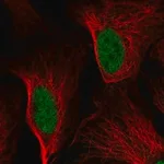 Merck Anti-DDIT3 antibody produced in rabbit