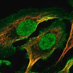 Merck Anti-RGS10 antibody produced in rabbit