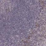 Merck Anti-P2RX5 antibody produced in rabbit