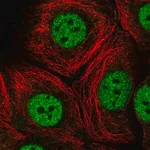 Merck Anti-MED13 antibody produced in rabbit