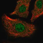 Merck Anti-ATP2A2 antibody produced in rabbit