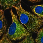 Merck Anti-MTUS1 antibody produced in rabbit