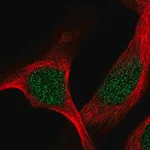 Merck Anti-TBRG1 antibody produced in rabbit