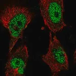 Merck Anti-POLK antibody produced in rabbit