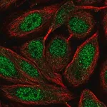 Merck Anti-ZNF630 antibody produced in rabbit