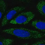 Merck Anti-ANKH antibody produced in rabbit