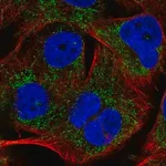 Merck Anti-PHYHIP antibody produced in rabbit