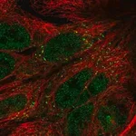 Merck Anti-TTI1 antibody produced in rabbit