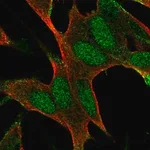 Merck Anti-BAALC antibody produced in rabbit