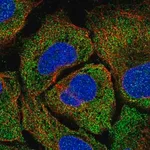 Merck Anti-TPTE2 antibody produced in rabbit