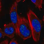 Merck Anti-ADAMTS4 antibody produced in rabbit