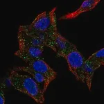 Merck Anti-KAT14 antibody produced in rabbit