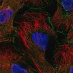 Merck Anti-ABI1 antibody produced in rabbit