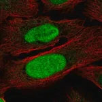 Merck Anti-ZNF776 antibody produced in rabbit