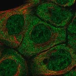 Merck Anti-BARX2 antibody produced in rabbit