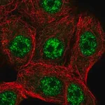 Merck Anti-STK19 antibody produced in rabbit