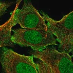 Merck Anti-BCORL1 antibody produced in rabbit