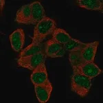 Merck Anti-HOXD9 antibody produced in rabbit