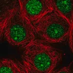 Merck Anti-GMPR2 antibody produced in rabbit