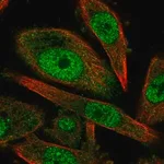 Merck Anti-CCNH antibody produced in rabbit