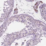 Merck Anti-CECR6 antibody produced in rabbit
