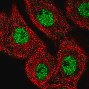 Merck Anti-MED25 antibody produced in rabbit