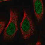 Merck Anti-RGMA antibody produced in rabbit