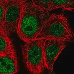Merck Anti-CHEK1 antibody produced in rabbit