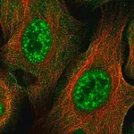 Merck Anti-ZNF337 antibody produced in rabbit