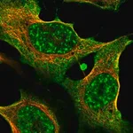 Merck Anti-THBS2 antibody produced in rabbit