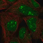 Merck Anti-L3MBTL3 antibody produced in rabbit