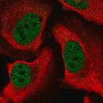 Merck Anti-CELF1 antibody produced in rabbit