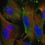 Merck Anti-TAMM41 antibody produced in rabbit