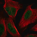 Merck Anti-NSMCE4A antibody produced in rabbit