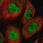 Merck Anti-KMT2A antibody produced in rabbit
