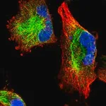 Merck Anti-C11orf95 antibody produced in rabbit