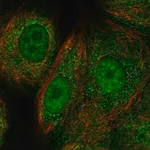 Merck Anti-RAD51C antibody produced in rabbit