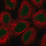 Merck Anti-ALKBH2 antibody produced in rabbit