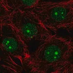 Merck Anti-NSUN5 antibody produced in rabbit